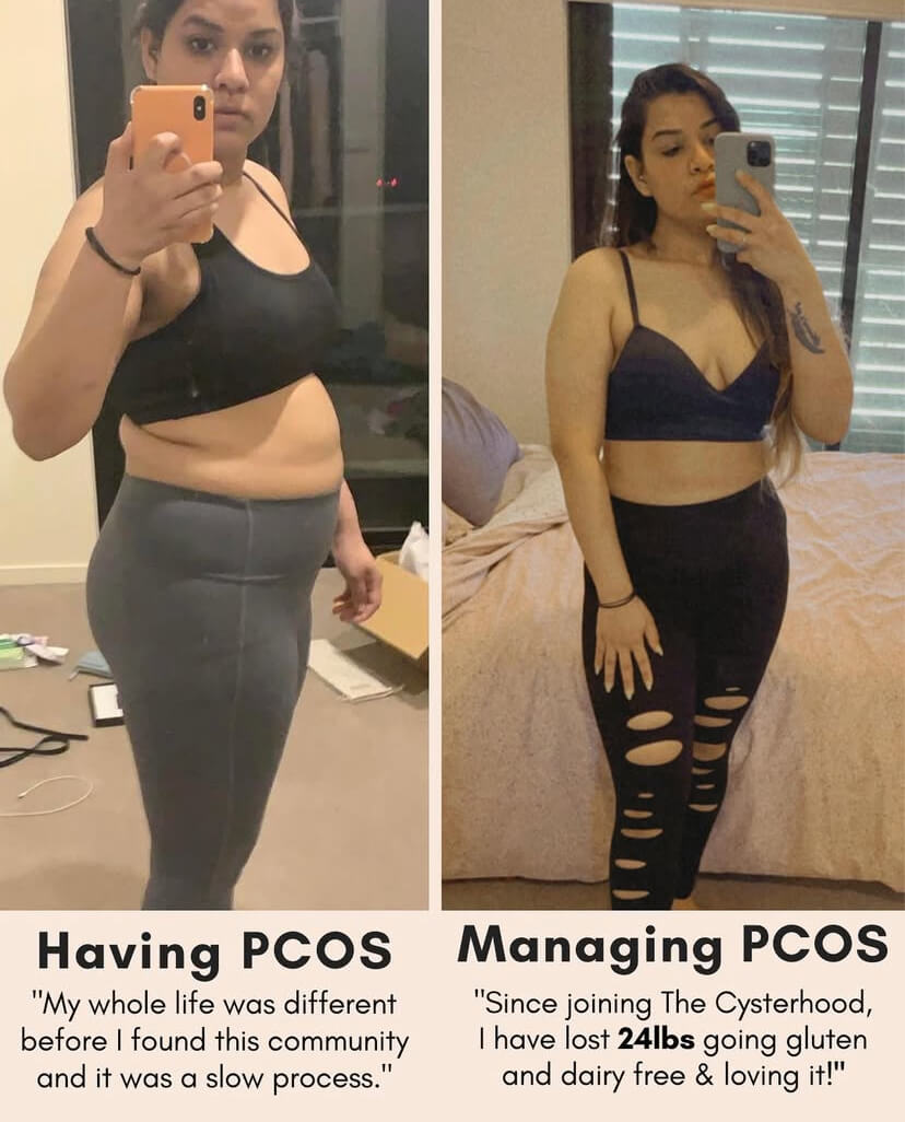 PCOS Guide Before After